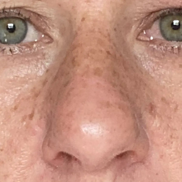 More even tone - After