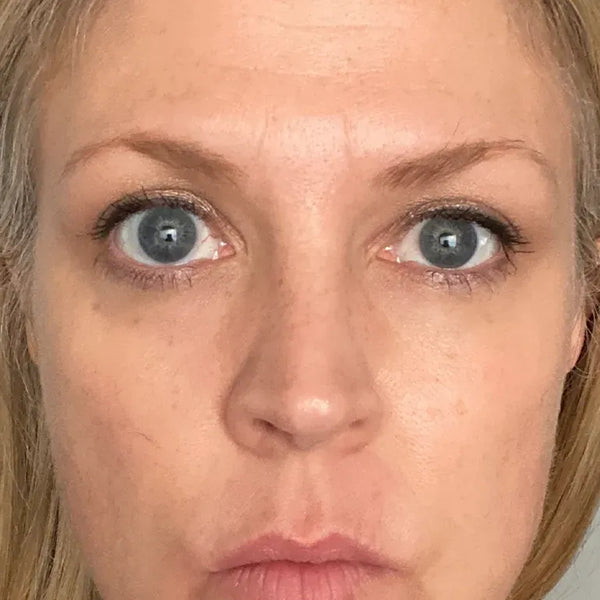 Brighter skin - Before