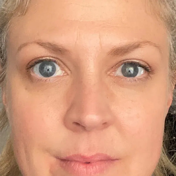 Brighter skin - After