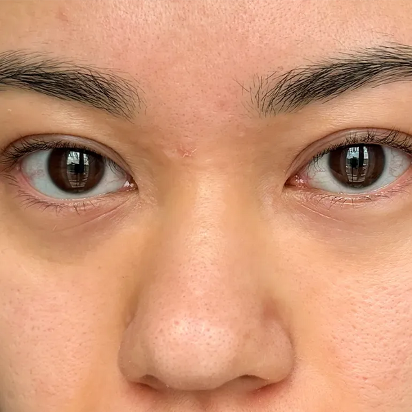 Refined texture - Before