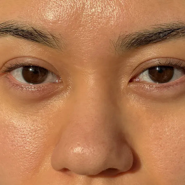 Refined texture - After